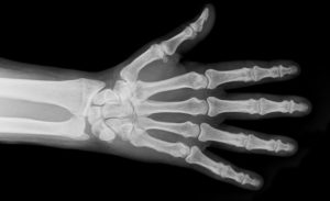 Who invented the X-Ray? - Famous Scientist